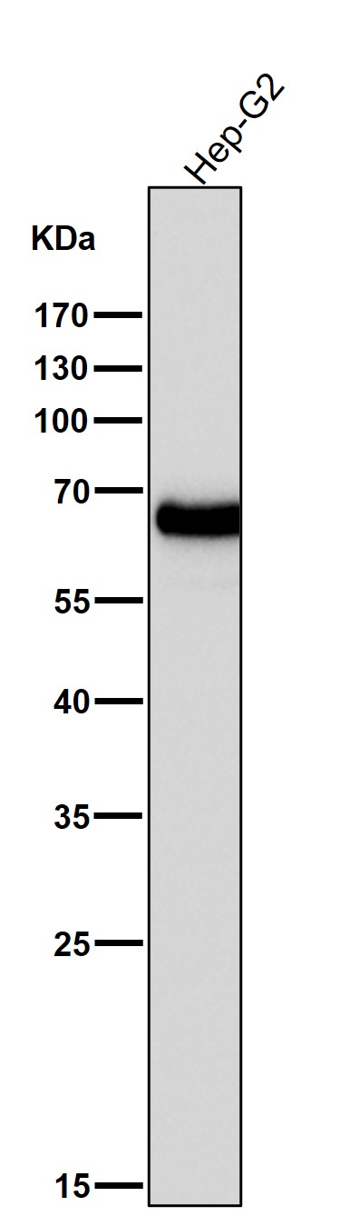 All lanes use the Antibody at 1:5K dilution for 1 hour at room temperature