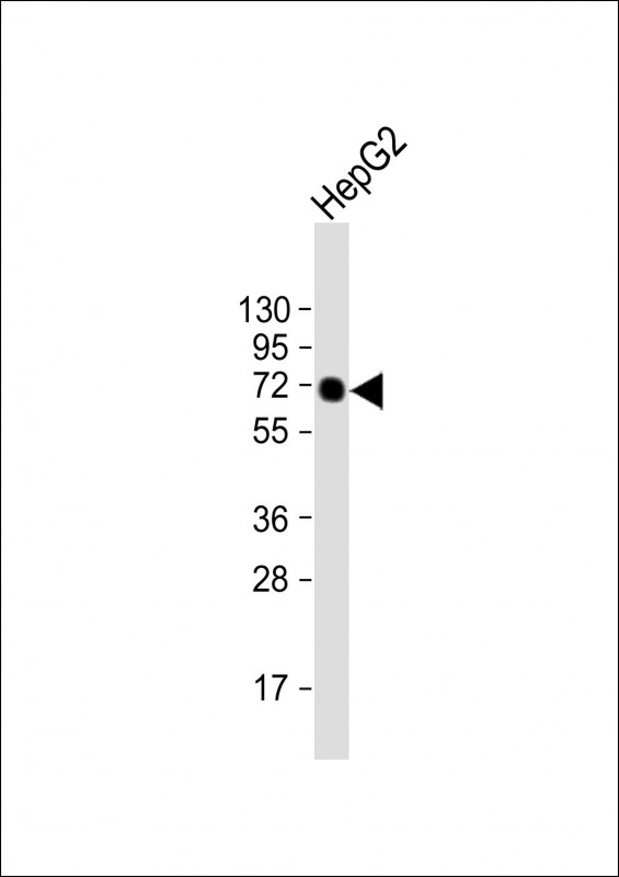 Anti-AFP Antibody at 1:500 dilution + HepG2 whole cell lysateLysates/proteins at 20 µg per lane