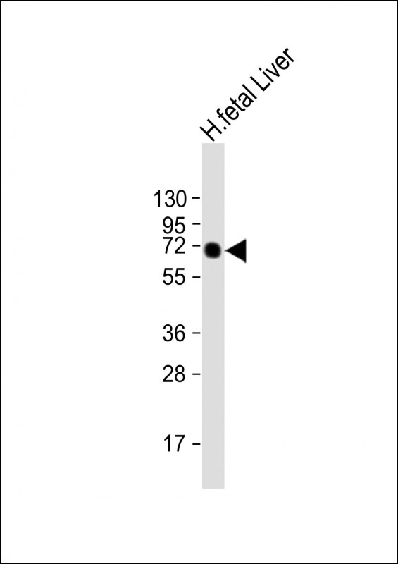 Anti-AFP Antibody at 1:2000 dilution + human fetal Liver lysateLysates/proteins at 20 µg per lane