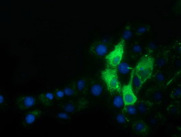 m00522 3 anti alpha 1 fetoprotein afp mouse monoclonal antibody clone id oti2a9 if testing 7
