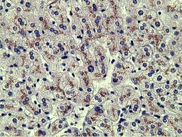 m00522 3 anti alpha 1 fetoprotein afp mouse monoclonal antibody clone id oti2a9 ihc testing 4