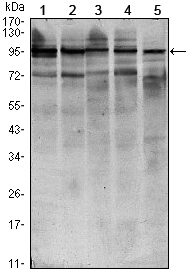 m00523 2 stat6 primary antibodies wb testing 2