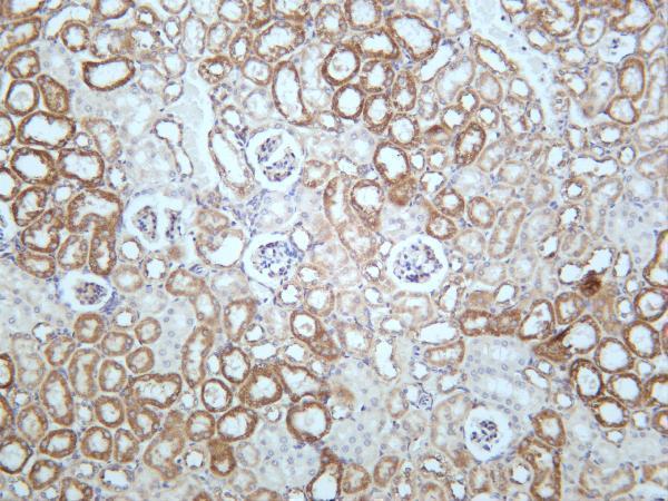 Mouse kidney was stained with anti-STAT6 rabbit antibody