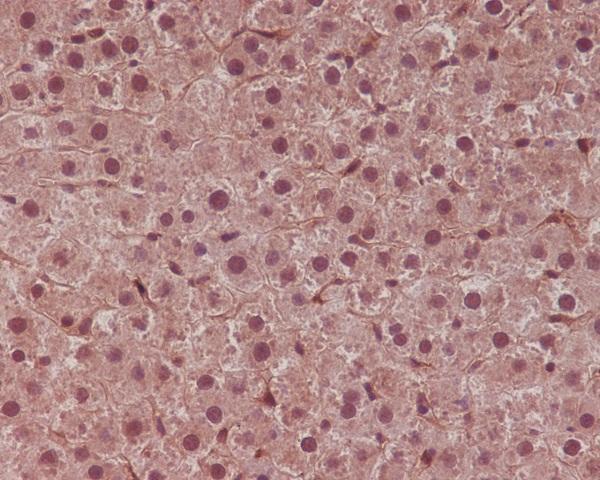 m00523 ihc