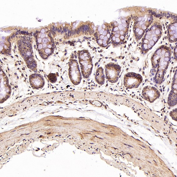 m00523 ihc7
