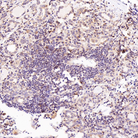 m00523 ihc8