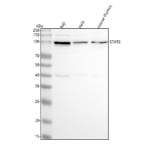 m00523 stat6 primary antibodies wb testing 1