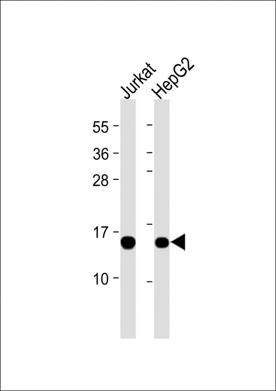 All lanes : Anti-RBX1 at dilutionLane 1: Jurkat whole cell lysateLane 2: HepG2 whole cell lysateLysates/proteins at 20 µg per lane