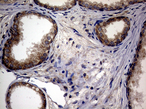 m00526 1 anti atg16l1 mouse monoclonal antibody clone id oti5a2 ihc testing 5