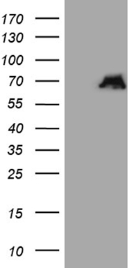 HEK293T cells were transfected with the pCMV6-ENTRY control (Left lane) or pCMV6-ENTRY ATG16L1 (Right lane) cDNA for 48 hrs and lysed