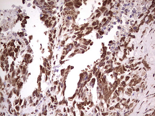 m00527 1 anti gli1 mouse monoclonal antibody clone id oti4e2 ihc testing 10