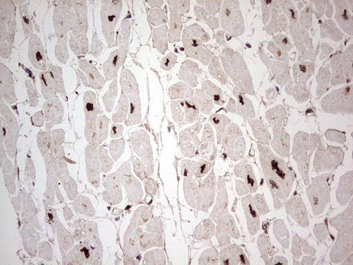 m00527 1 anti gli1 mouse monoclonal antibody clone id oti4e2 ihc testing 3