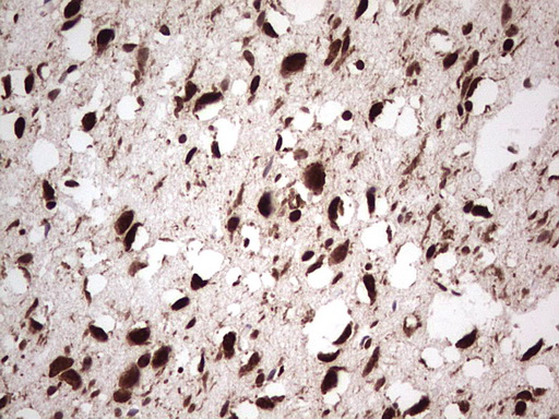m00527 1 anti gli1 mouse monoclonal antibody clone id oti4e2 ihc testing 4