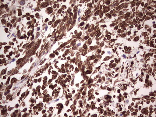 m00527 1 anti gli1 mouse monoclonal antibody clone id oti4e2 ihc testing 5