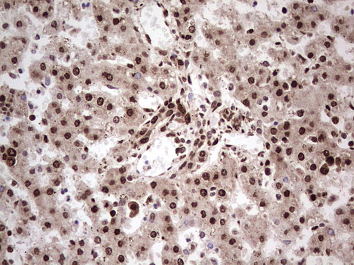 m00527 1 anti gli1 mouse monoclonal antibody clone id oti4e2 ihc testing 6
