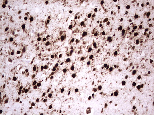 m00527 1 anti gli1 mouse monoclonal antibody clone id oti4e2 ihc testing 8