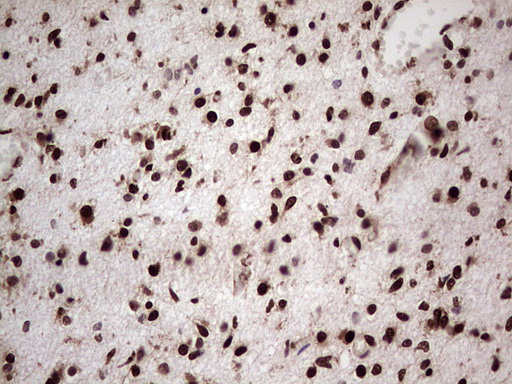 m00527 1 anti gli1 mouse monoclonal antibody clone id oti4e2 ihc testing 9
