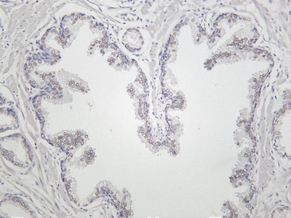 m00532 3 kdm1a primary antibodies ihc testing 3