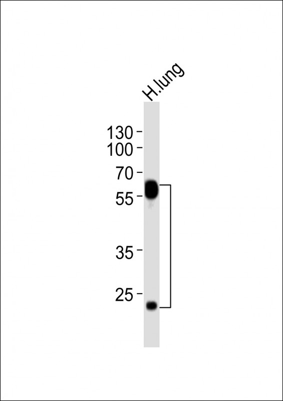 m00534 1 anti flt1 antibody wb testing 1