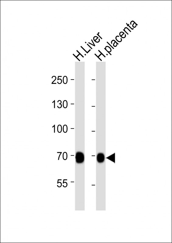 m00534 1 anti flt1 antibody wb testing 2