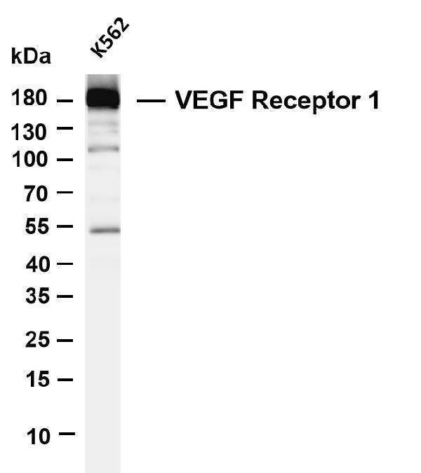 Various whole cell lysates were separated by 4-20% SDS-PAGE, and the membrane was blotted with anti-VEGF Receptor 1 antibody