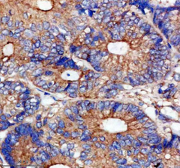 IHC analysis of VEGFR1/FLT1 using anti-VEGFR1/FLT1 antibody (M00534)