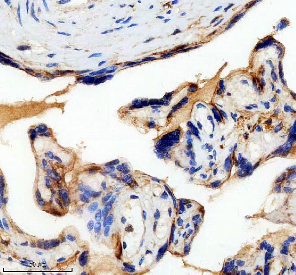 m00534 flt1 primary antibodies ihc testing 2_1