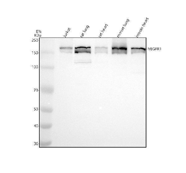 Western blot analysis of VEGFR1/FLT1 using anti-VEGFR1/FLT1 antibody (M00534)