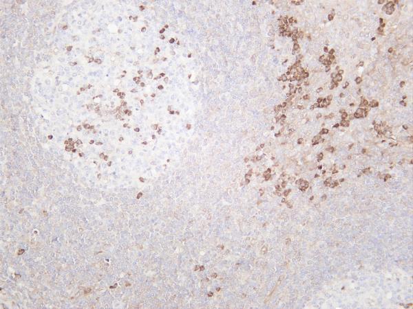 Humantonsil was stained with anti-MLKL rabbit antibody