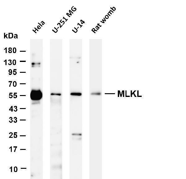 Various whole cell lysates were separated by 4-20% SDS-PAGE, and the membrane was blotted with anti-MLKL antibody