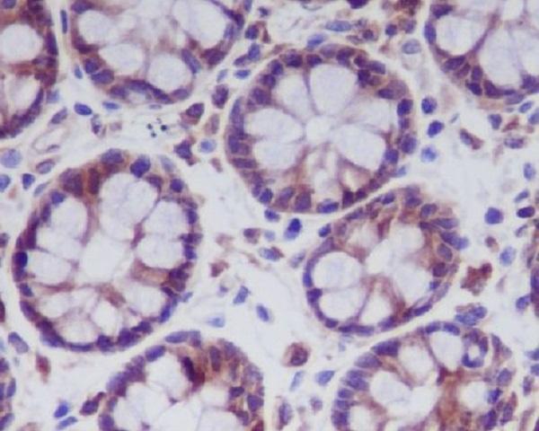 Immunohistochemical analysis of paraffin-embedded human colon, using MLKL Antibody