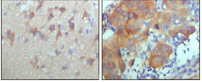 Immunohistochemistry analysis of paraffin-embedded human cerebra (left) and breast carcinoma tissue (right), showing cytoplasmic and membrane location with DAB staining using ErbB-3 Monoclonal Antibody