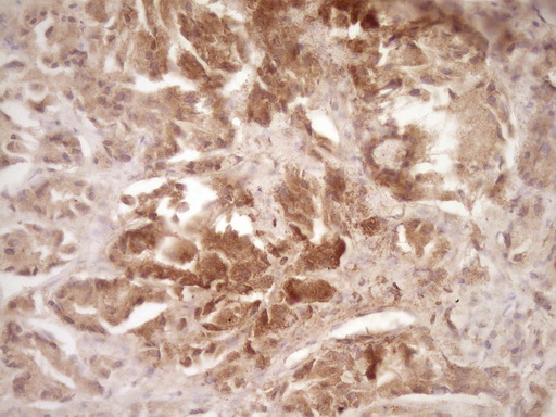 m00539 2 anti erbb 3 erbb3 mouse monoclonal antibody clone id oti3e10 ihc testing 4