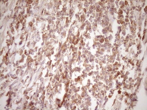 m00539 2 anti erbb 3 erbb3 mouse monoclonal antibody clone id oti3e10 ihc testing 5