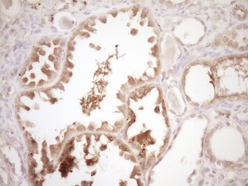m00539 2 anti erbb 3 erbb3 mouse monoclonal antibody clone id oti3e10 ihc testing 6