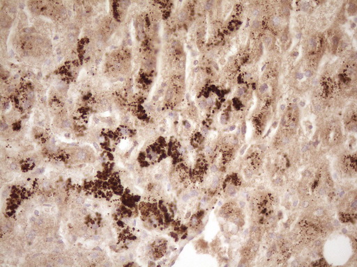 m00539 2 anti erbb 3 erbb3 mouse monoclonal antibody clone id oti3e10 ihc testing 7