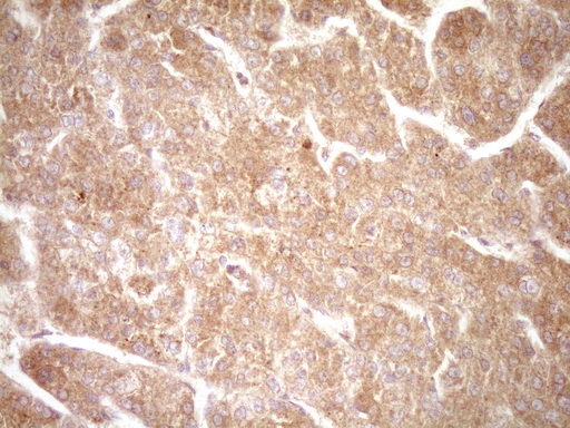 m00539 2 anti erbb 3 erbb3 mouse monoclonal antibody clone id oti3e10 ihc testing 8