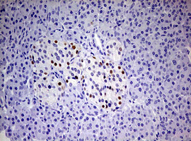 m00541 4 anti progesterone receptor pgr mouse monoclonal antibody clone id oti4b3 ihc testing 2