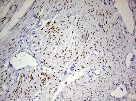m00541 4 anti progesterone receptor pgr mouse monoclonal antibody clone id oti4b3 ihc testing 3