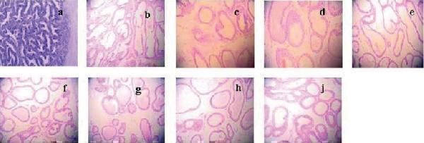 Effect of E 2 on prostate pathology when TP was 0