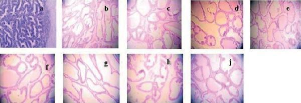 Effect of E 2 on prostate pathology when TP was 0