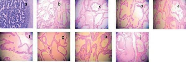 Effect of E 2 on prostate pathology when TP was 3