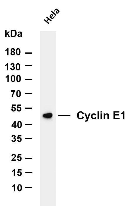 Various whole cell lysates were separated by 4-20% SDS-PAGE, and the membrane was blotted with anti-Cyclin E1 antibody