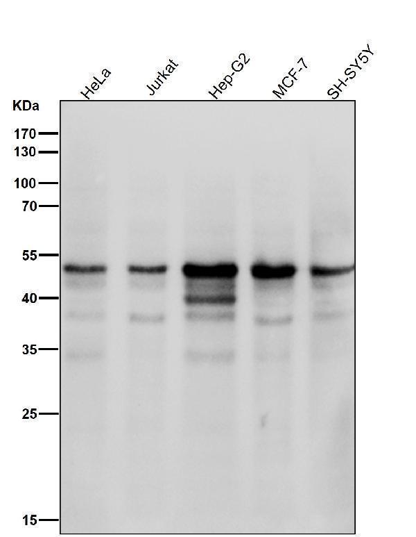 All lanes use the Antibody at 1:2K dilution for 1 hour at room temperature