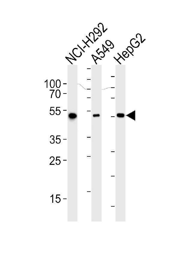 m00546 4 aldh2 primary antibodies wb testing 1