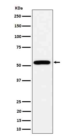 Western blot analysis of ALDH2 expression in HepG2 cell lysate