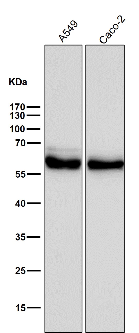 All lanes use the Antibody at 1:3K dilution for 1 hour at room temperature
