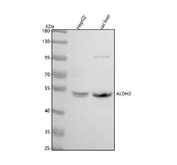 m00546 aldh2 primary antibodies wb testing 1