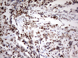 m00548 1 anti areb6 zeb1 mouse monoclonal antibody clone id oti3g6 ihc testing 5