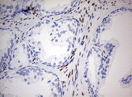 m00548 1 anti areb6 zeb1 mouse monoclonal antibody clone id oti3g6 ihc testing 6